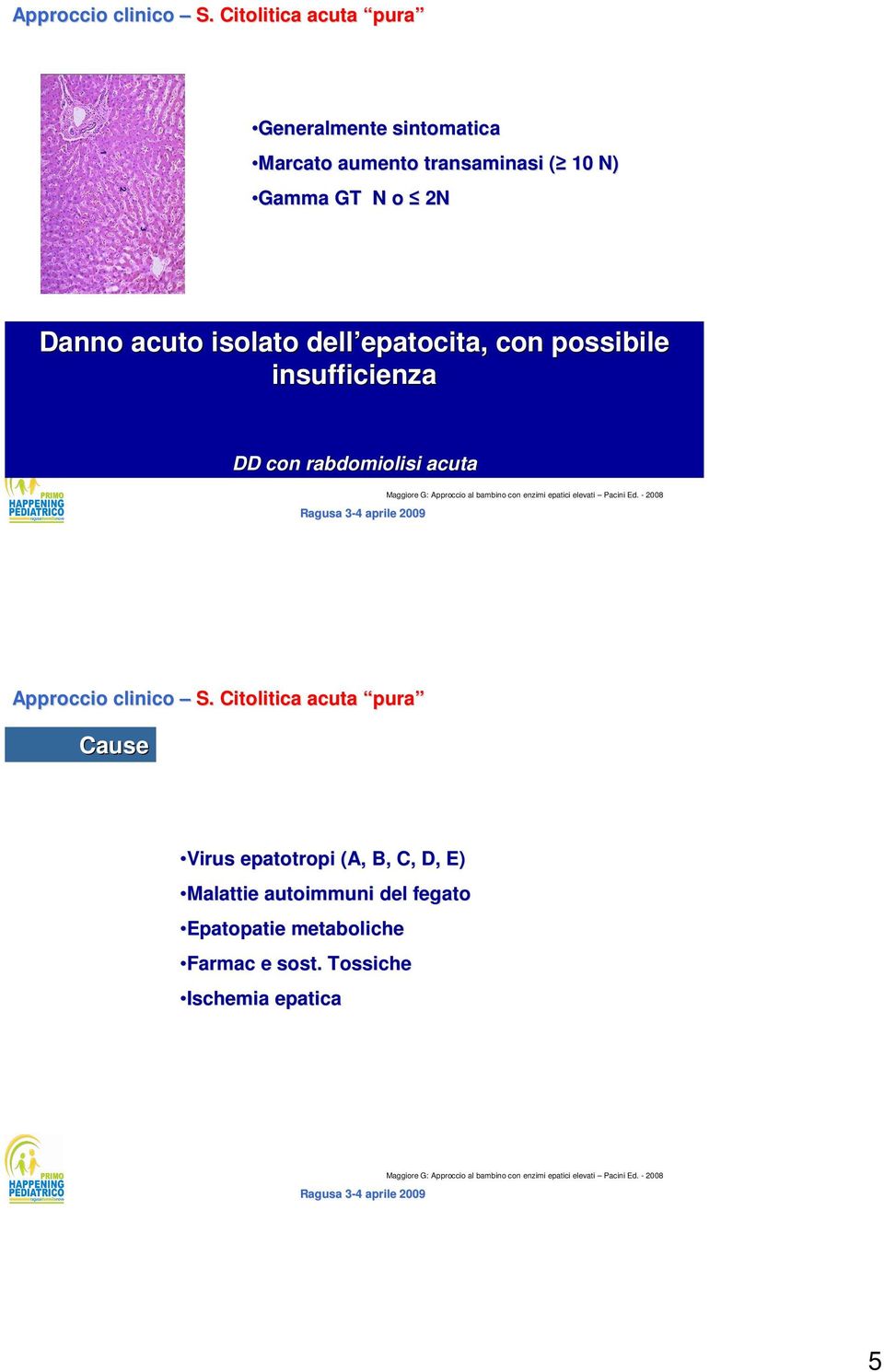 2N Danno acuto isolato dell epatocita, epatocita, con possibile insufficienza DD con rabdomiolisi