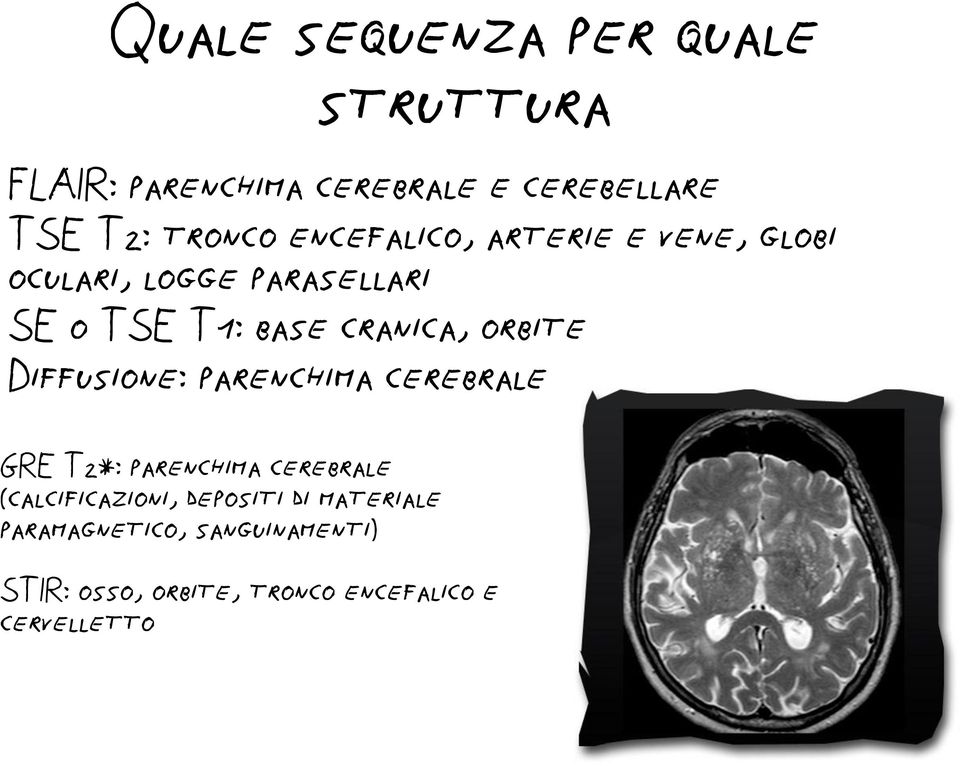 orbite Diffusione: parenchima cerebrale GRE T2*: parenchima cerebrale (calcificazioni,