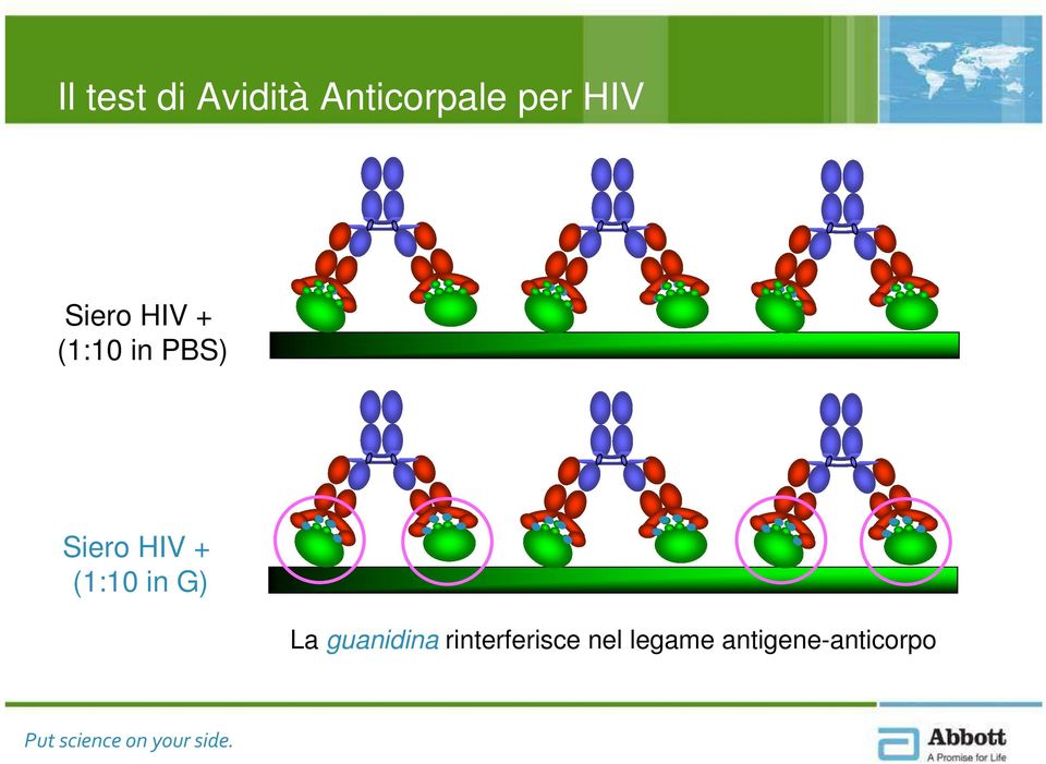 HIV + (1:10 in G) La guanidina