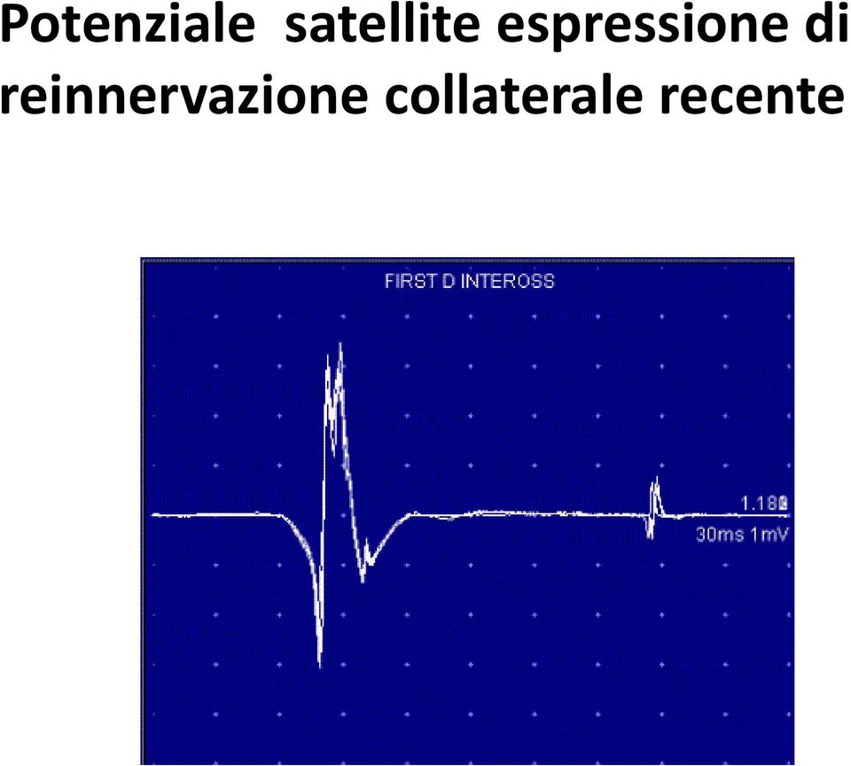 espressione di