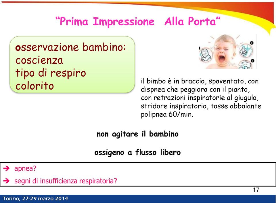 retrazioni inspiratorie al giugulo, stridore inspiratorio, tosse abbaiante polipnea