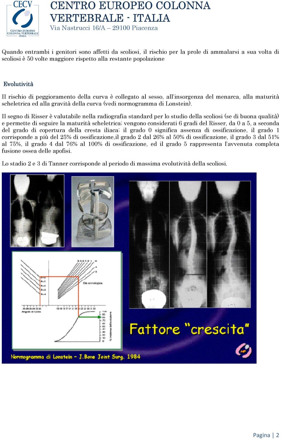 Il segno di Risser è valutabile nella radiografia standard per lo studio della scoliosi (se di buona qualità) e permette di seguire la maturità scheletrica; vengono considerati 6 gradi del Risser, da