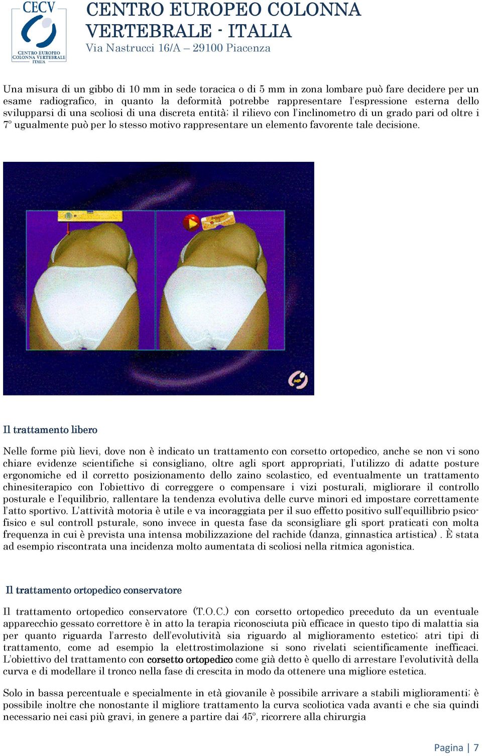 Il trattamento libero Nelle forme più lievi, dove non è indicato un trattamento con corsetto ortopedico, anche se non vi sono chiare evidenze scientifiche si consigliano, oltre agli sport