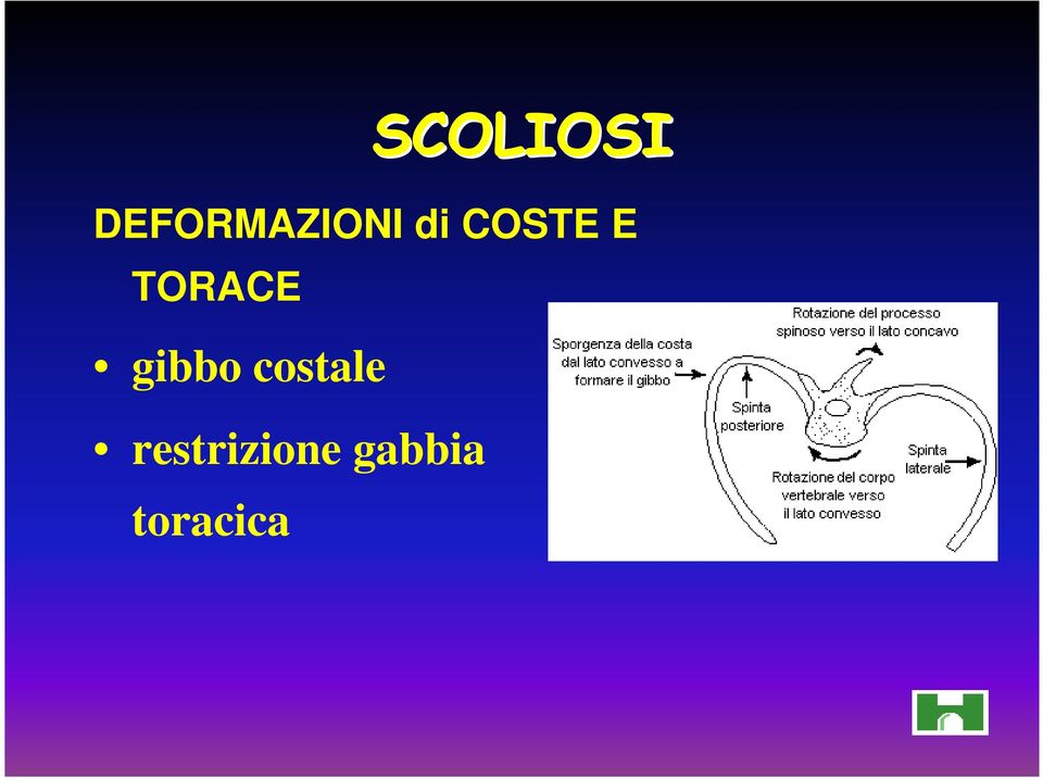 gibbo costale