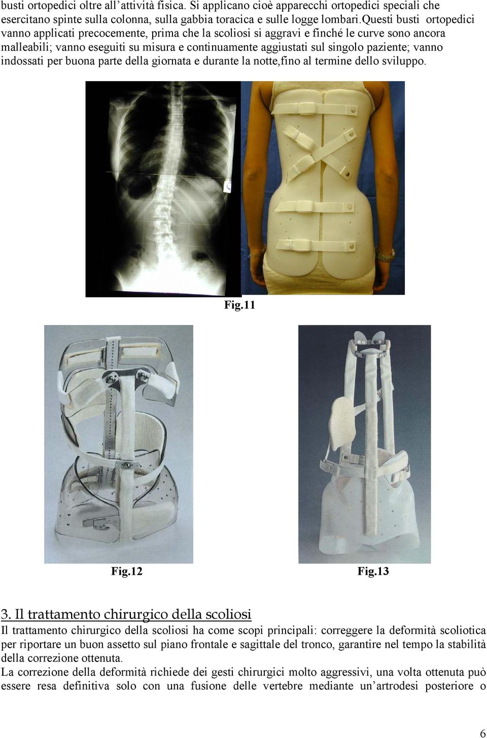 paziente; vanno indossati per buona parte della giornata e durante la notte,fino al termine dello sviluppo. Fig.11 Fig.12 Fig.13 3.