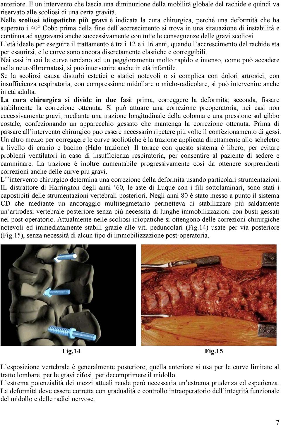 continua ad aggravarsi anche successivamente con tutte le conseguenze delle gravi scoliosi.