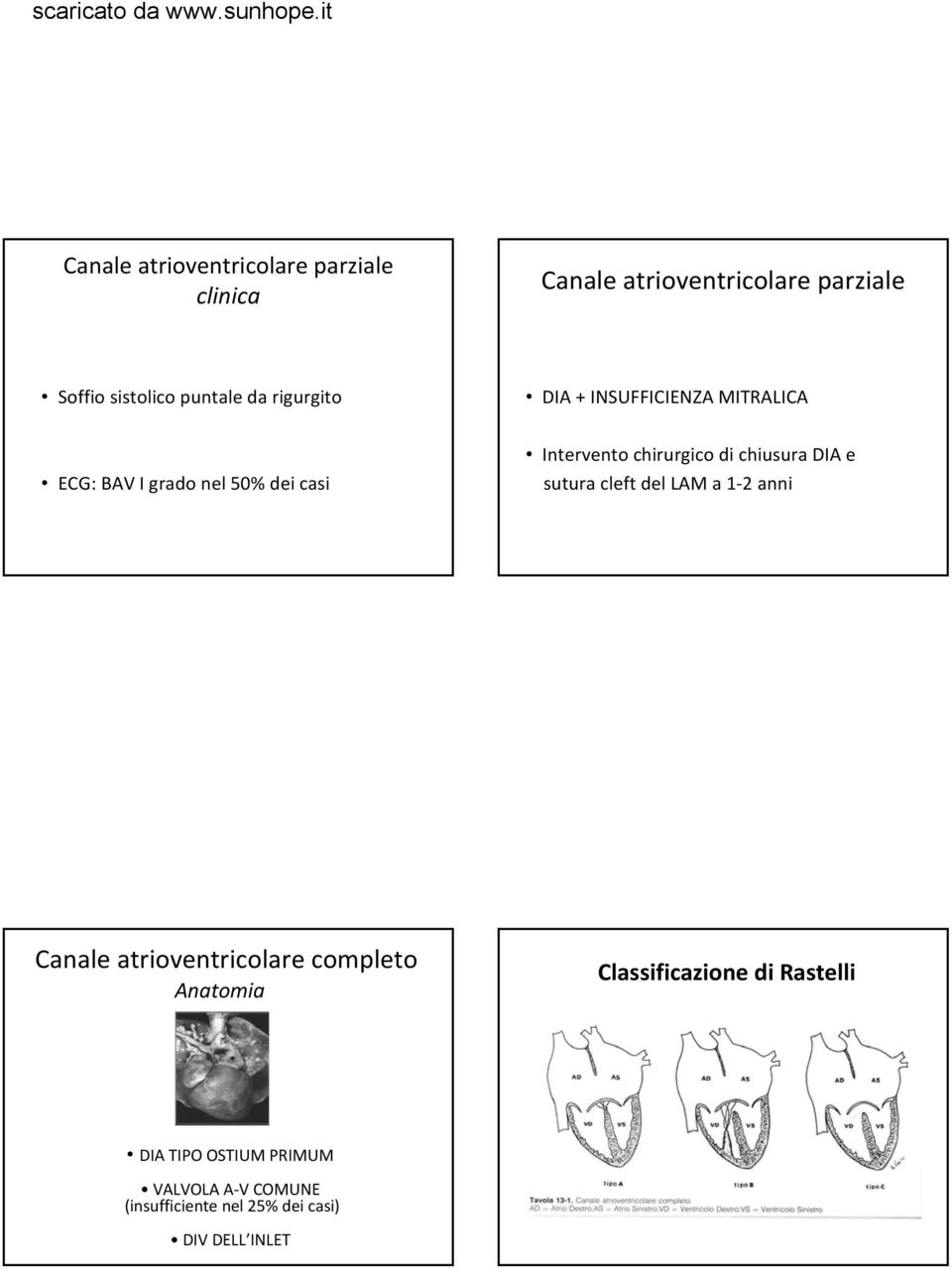 chiusura DIA e sutura cleft del LAM a 1 2 anni Canale atrioventricolare completo Anatomia