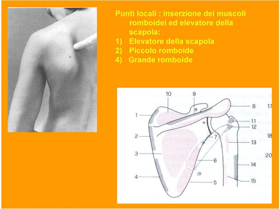 della scapola: 1) Elevatore della