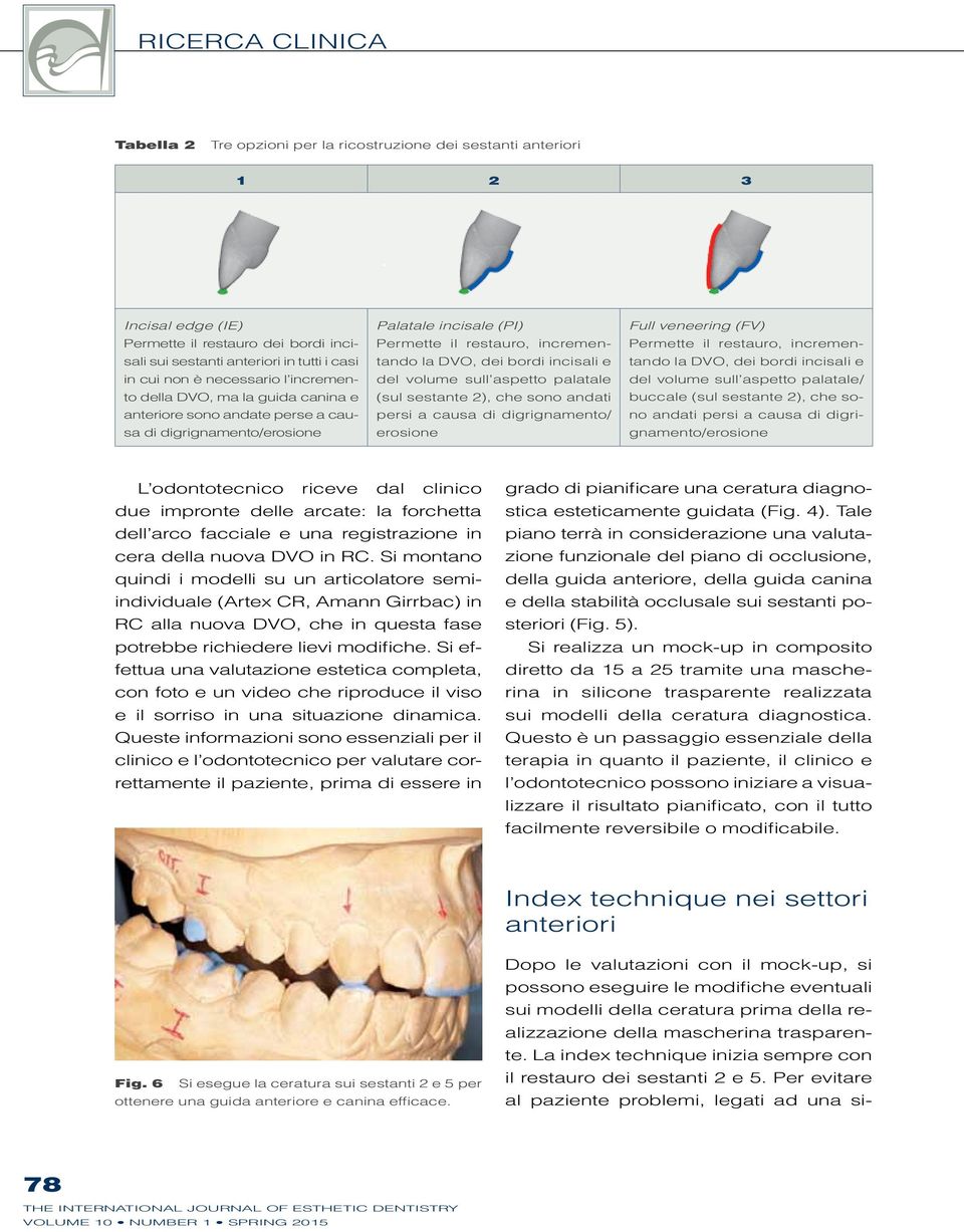 incisali e del volume sull aspetto palatale (sul sestante 2), che sono andati persi a causa di digrignamento/ erosione Full veneering (FV) Permette il restauro, incrementando la DVO, dei bordi