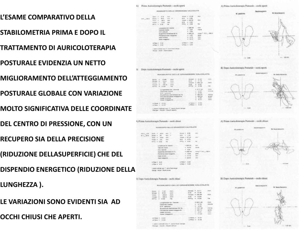 COORDINATE DEL CENTRO DI PRESSIONE, CON UN RECUPERO SIA DELLA PRECISIONE (RIDUZIONE DELLASUPERFICIE) CHE