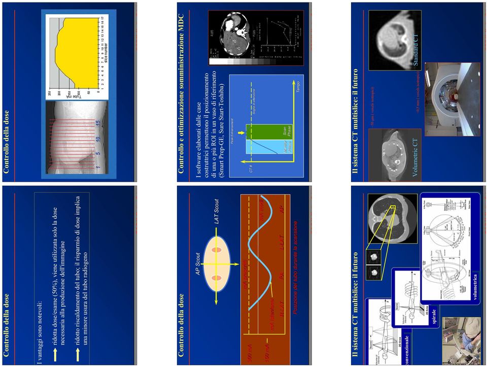 permettono il posizionamento di una o più ROI in un vaso di riferimento (Smart Prep-GE, Sure Start-Toshiba) Peak Enhancement 300 ma ma prescritti CT # Soglia di attenzione 150 ma ma istantanei ma