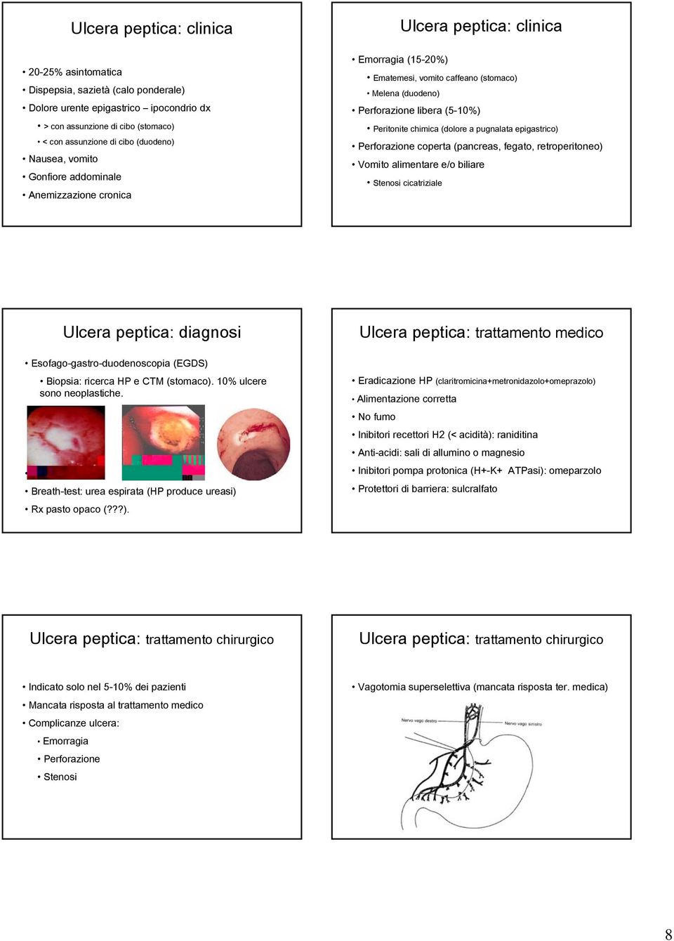 (dolore a pugnalata epigastrico) Perforazione coperta (pancreas, fegato, retroperitoneo) Vomito alimentare e/o biliare Stenosi cicatriziale Ulcera peptica: diagnosi Esofago-gastro-duodenoscopia