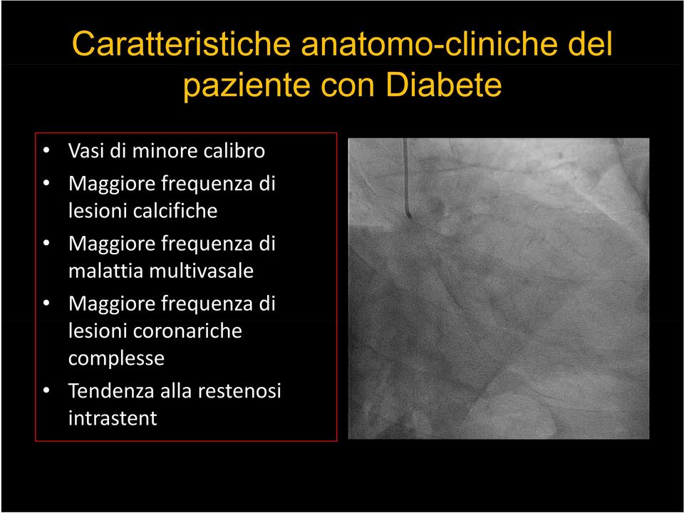 malattia multivasale Maggiore frequenza di lesioni coronariche