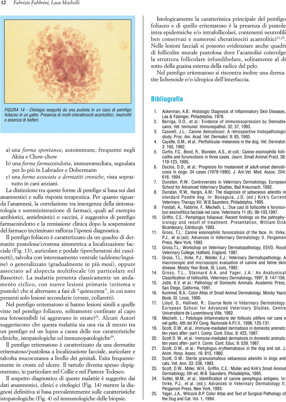 Nelle lesioni facciali si possono evidenziare anche quadri di follicolite murale pustolosa dove l acantolisi coinvolge la struttura follicolare infundibolare, solitamente al di sotto della guaina