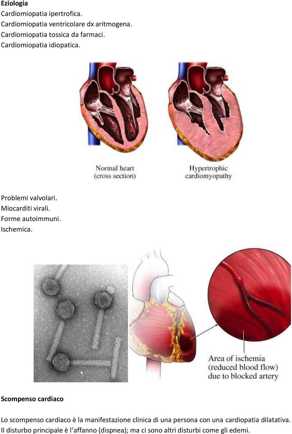 Forme autoimmuni. Ischemica.