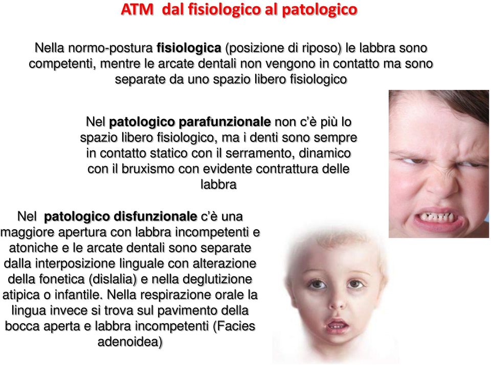 evidente contrattura delle labbra Nel patologico disfunzionale c è una maggiore apertura con labbra incompetenti e atoniche e le arcate dentali sono separate dalla interposizione linguale con