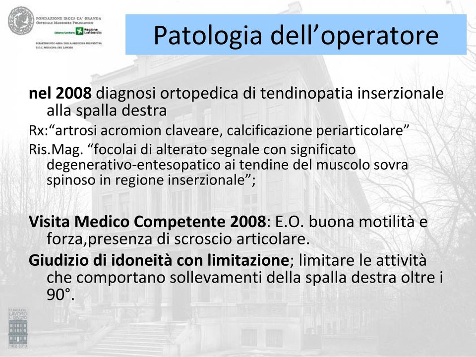 focolai di alterato segnale con significato degenerativo-entesopatico ai tendine del muscolo sovra spinoso in regione