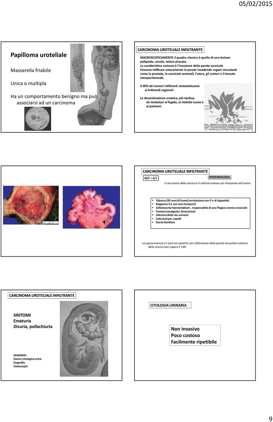 La caratteristica comune è l invasione della parete vescicale Possono infiltrare estesamente la parete invadendo organi circostanti come la prostata, le vescicole seminali, l utero, gli ureteri e il