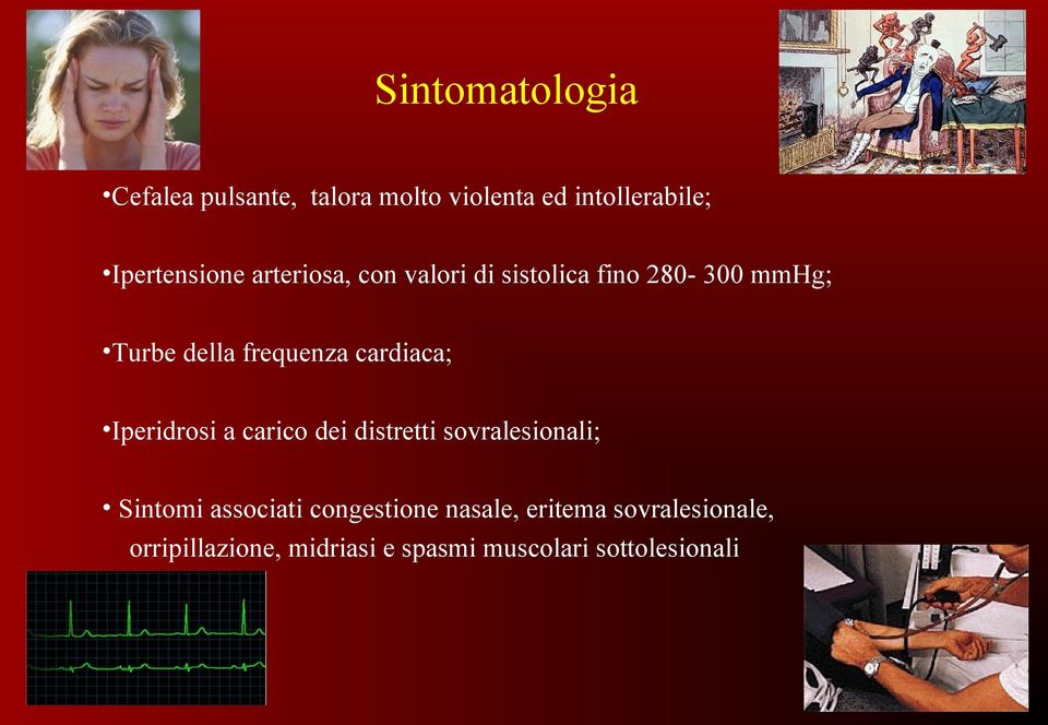 Iperidrosi a carico dei distretti sovralesionali; Sintomi associati congestione