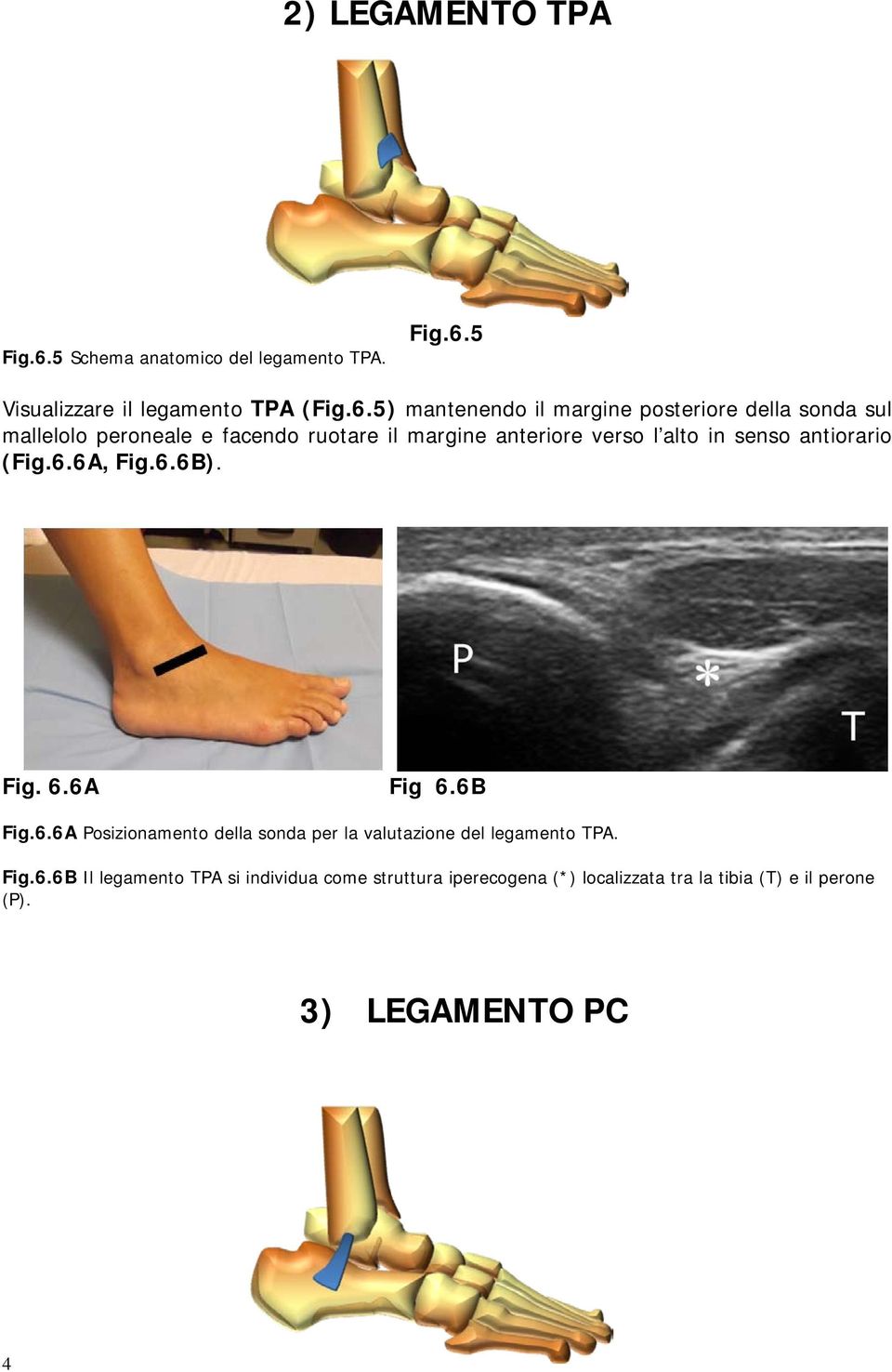 5 Visualizzare il legamento TPA (Fig.6.