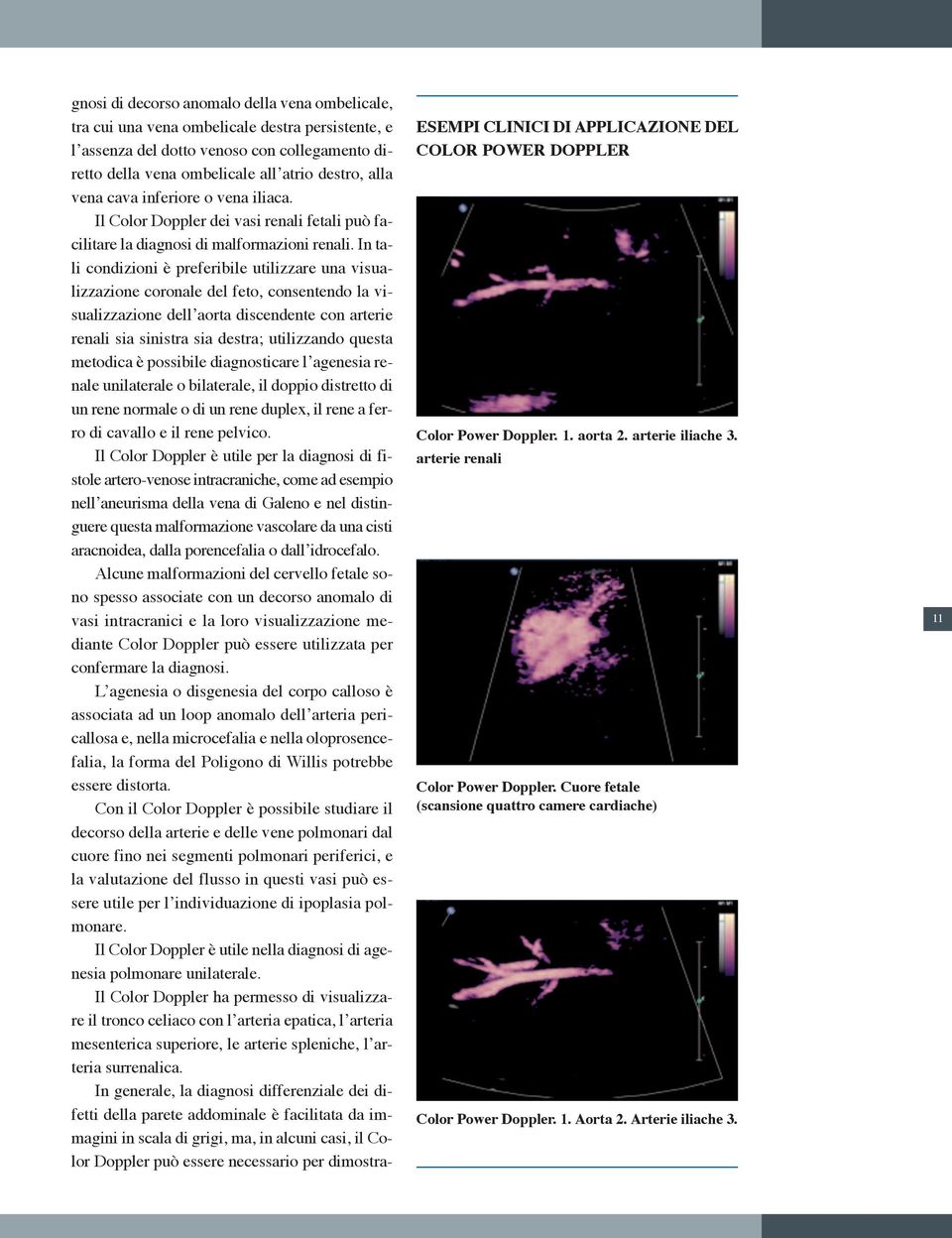 In tali condizioni è preferibile utilizzare una visualizzazione coronale del feto, consentendo la visualizzazione dell aorta discendente con arterie renali sia sinistra sia destra; utilizzando questa