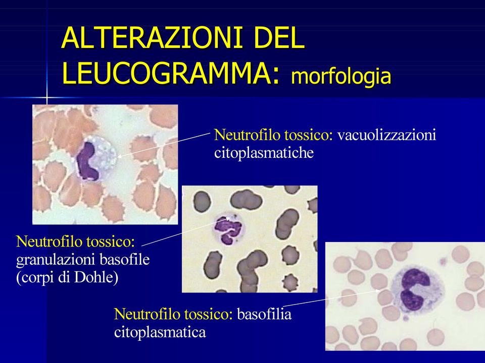 tossico: granulazioni basofile (corpi di