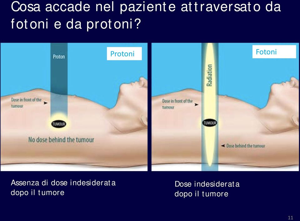 Protoni Fotoni Assenza di dose