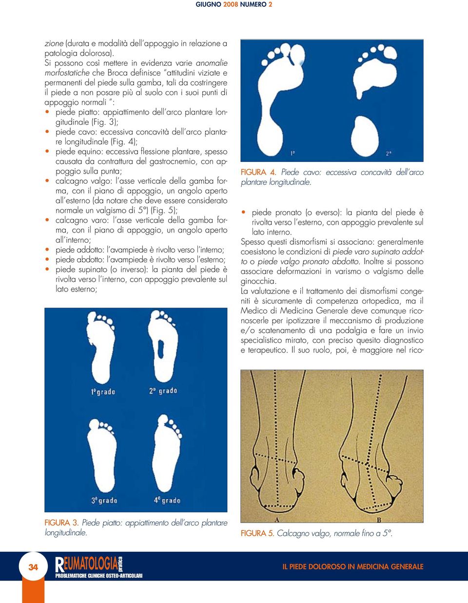 i suoi punti di appoggio normali : piede piatto: appiattimento dell arco plantare longitudinale (Fig. 3); piede cavo: eccessiva concavità dell arco plantare longitudinale (Fig.