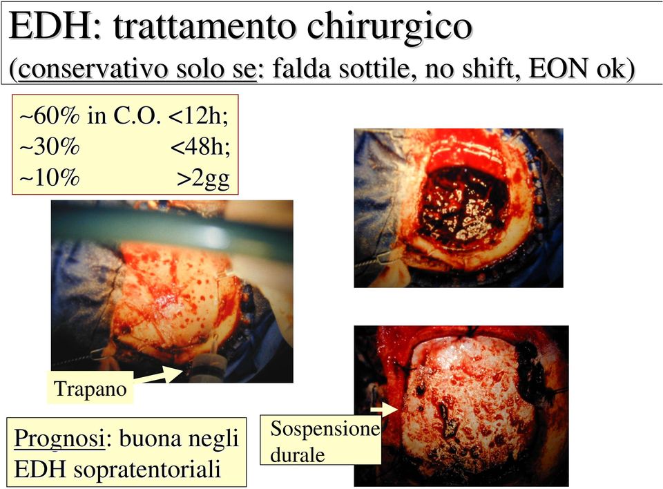 O. <12h; 30% <48h; 10% >2gg Trapano Prognosi: :