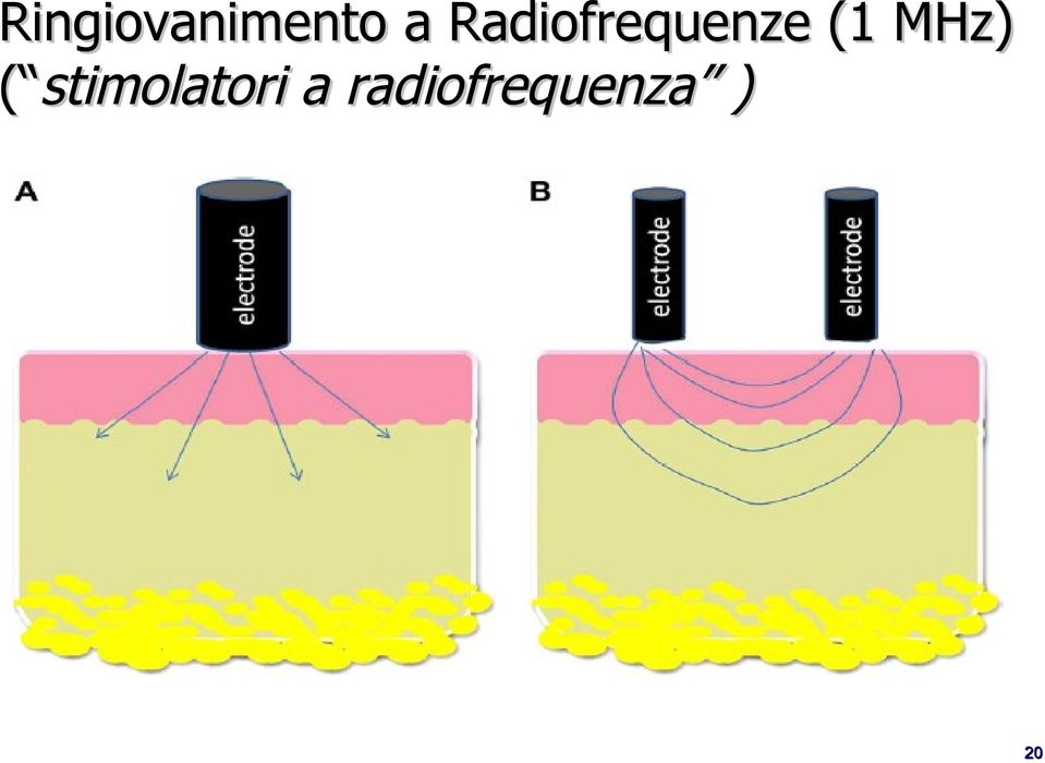 MHz) ( stimolatori