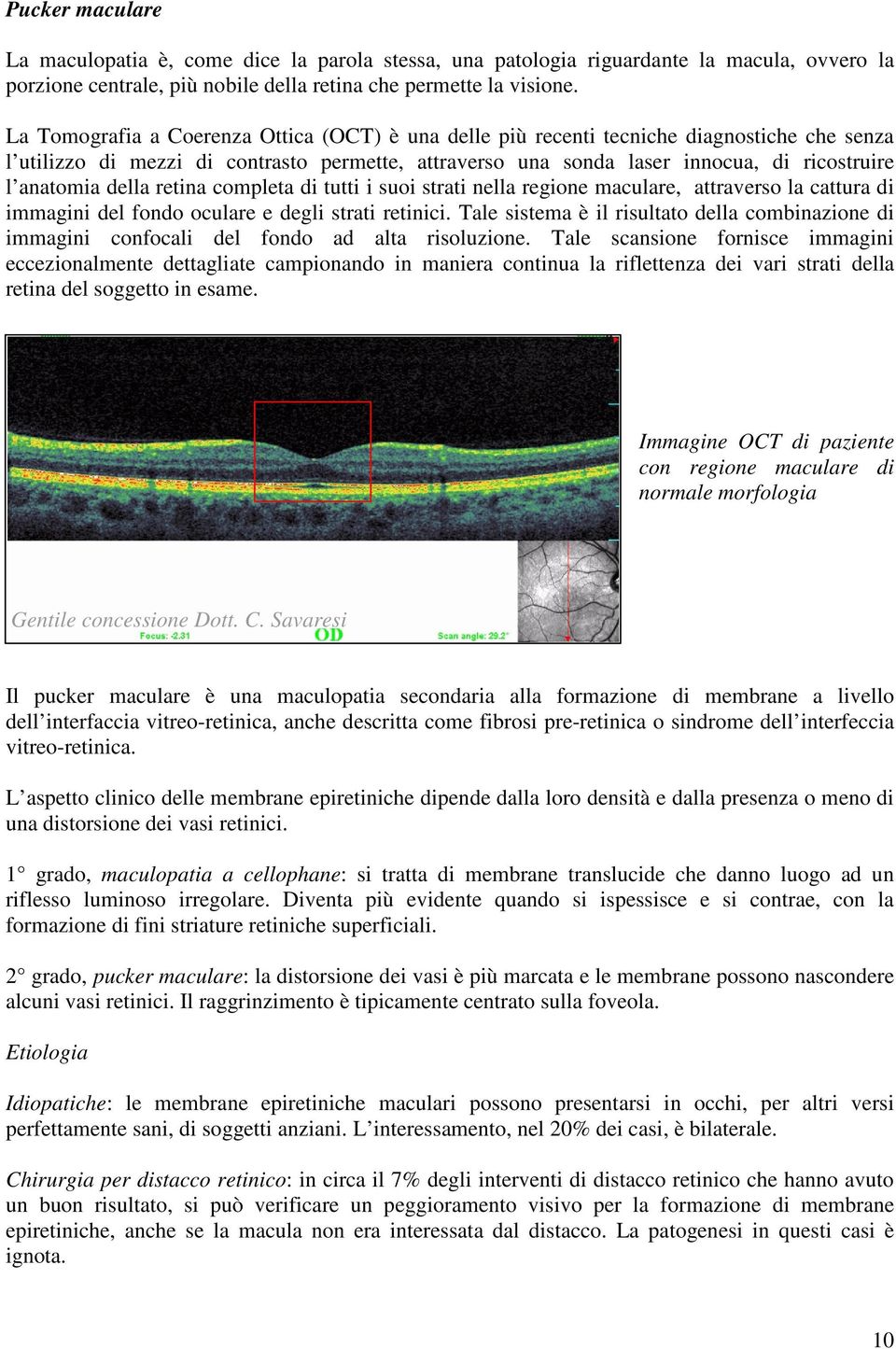 della retina completa di tutti i suoi strati nella regione maculare, attraverso la cattura di immagini del fondo oculare e degli strati retinici.