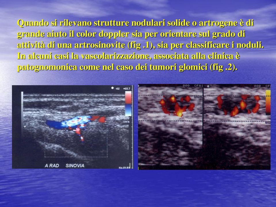 (fig.1), sia per classificare i noduli.