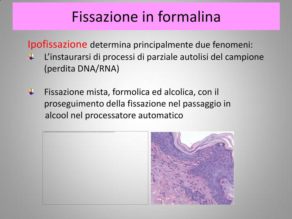 (perdita DNA/RNA) Fissazione mista, formolica ed alcolica, con il