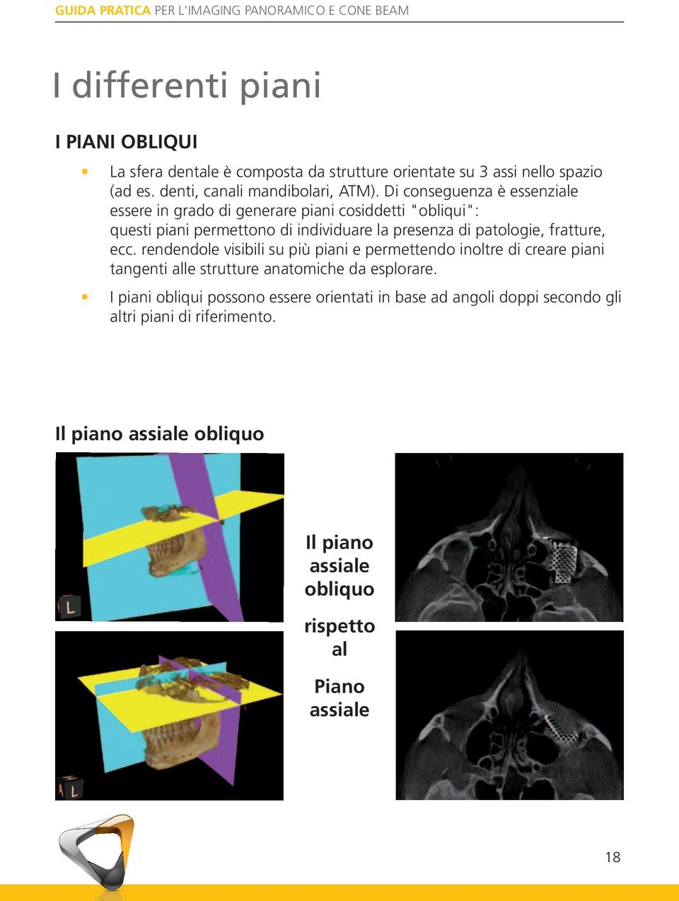 fratture, ecc. rendendole visibili su più piani e permettendo inoltre di creare piani tangenti alle strutture anatomiche da esplorare.