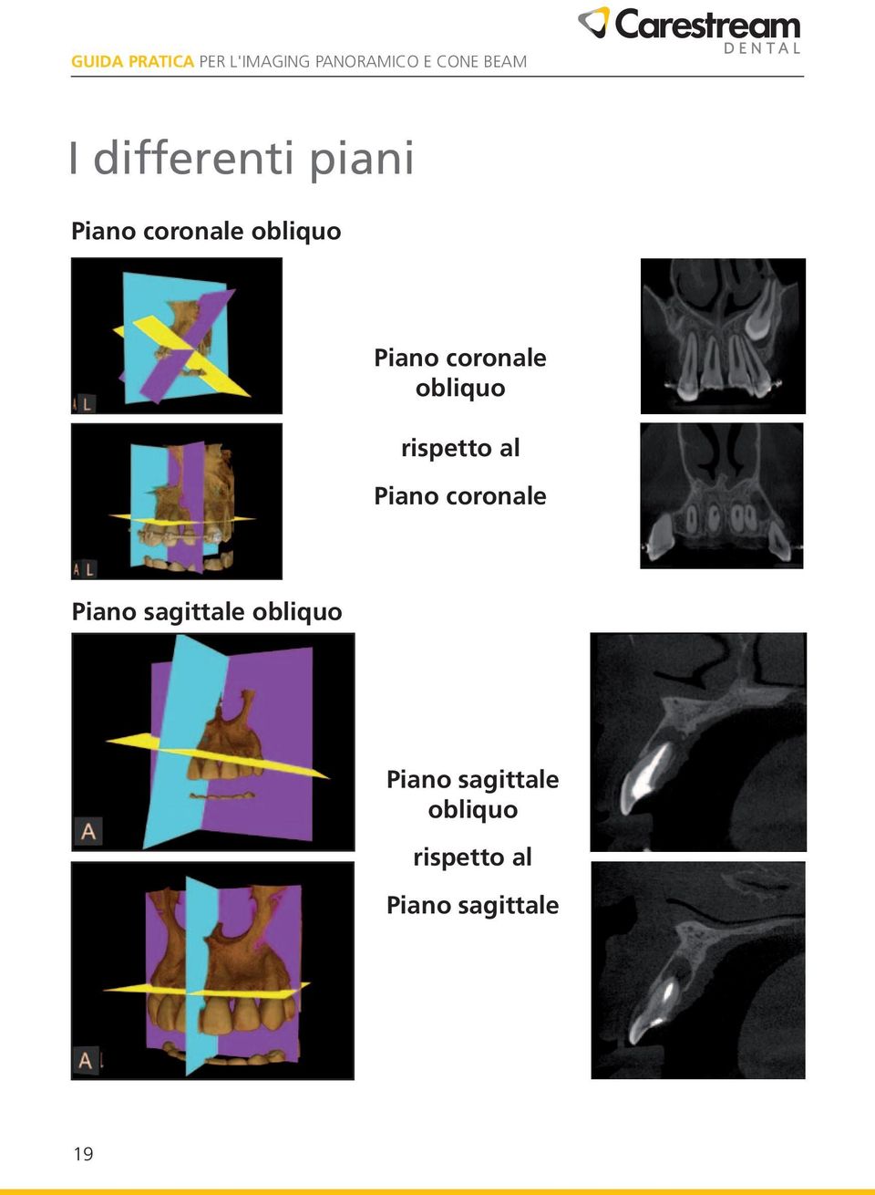 coronale Piano sagittale obliquo Piano