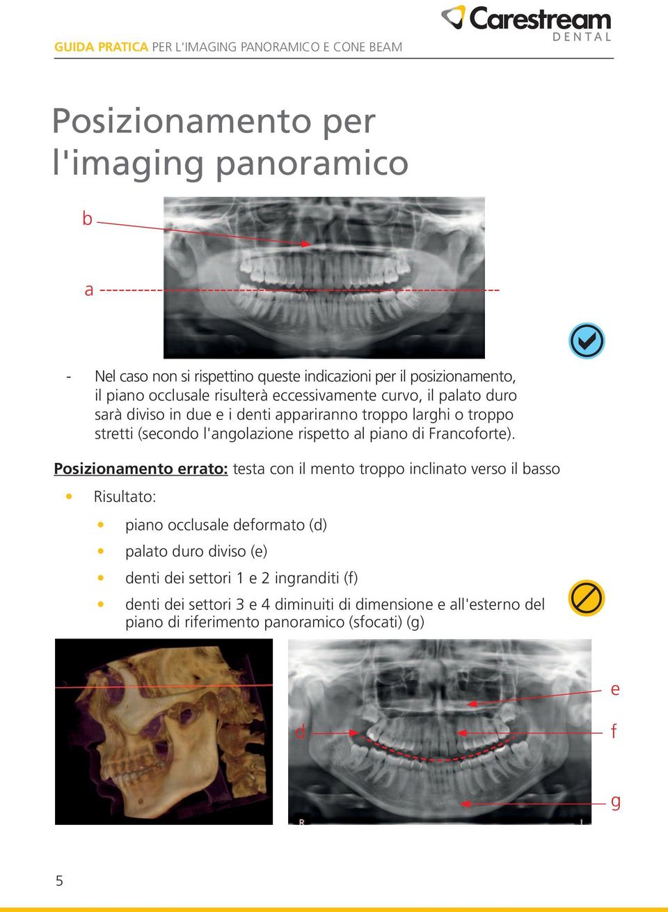 l'angolazione rispetto al piano di Francoforte).