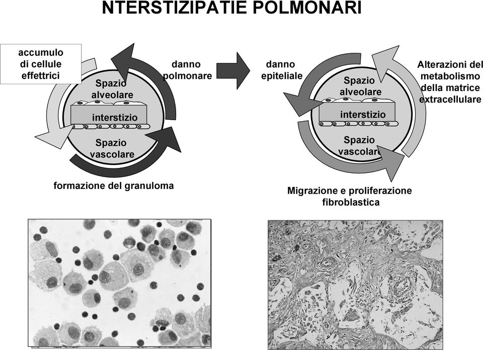 Alterazioni del metabolismo della matrice extracellulare interstizio interstizio