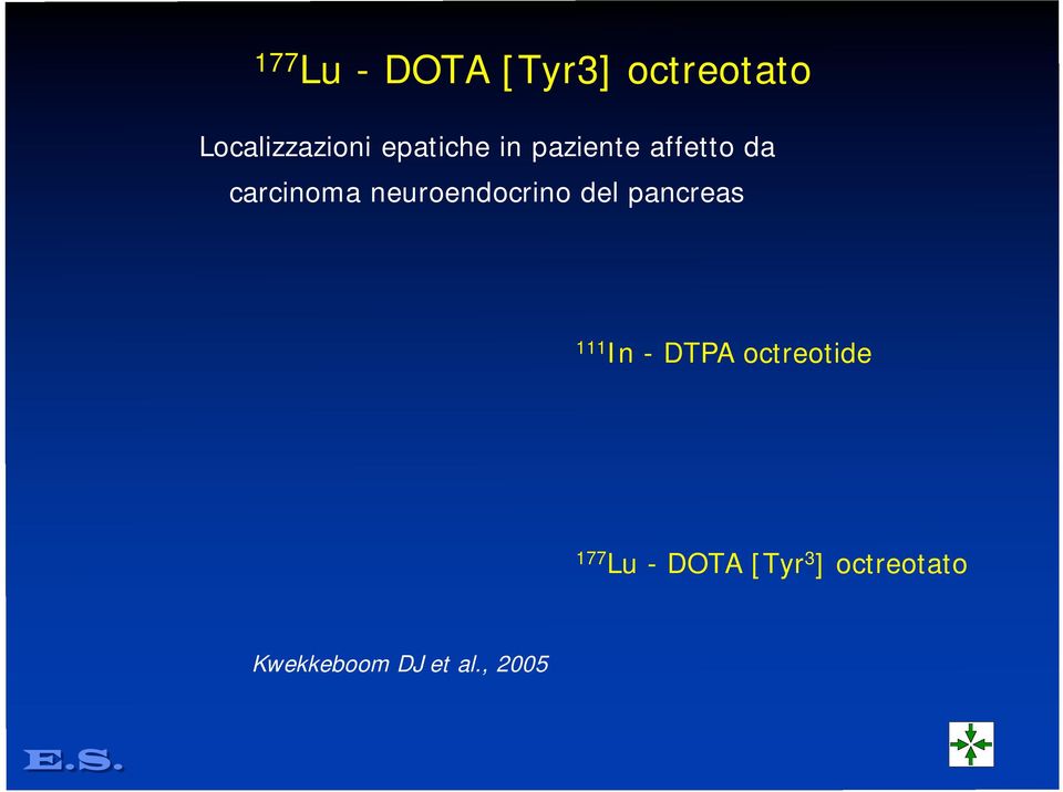 neuroendocrino del pancreas 111 In - DTPA