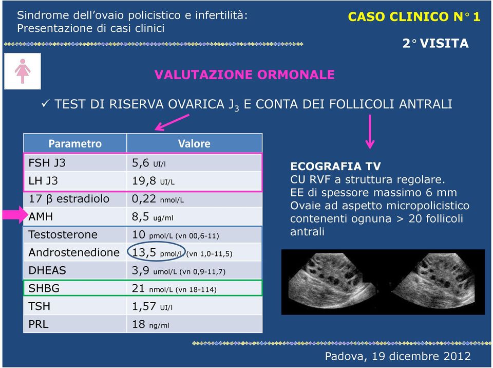 a struttura regolare.