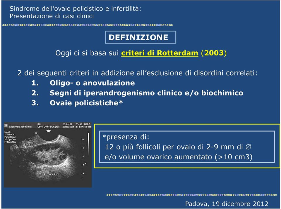 Segni di iperandrogenismo clinico e/o biochimico 3.