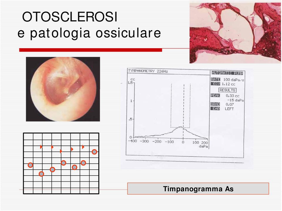 ossiculare