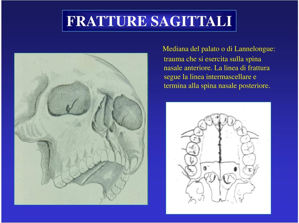 nasale anteriore.