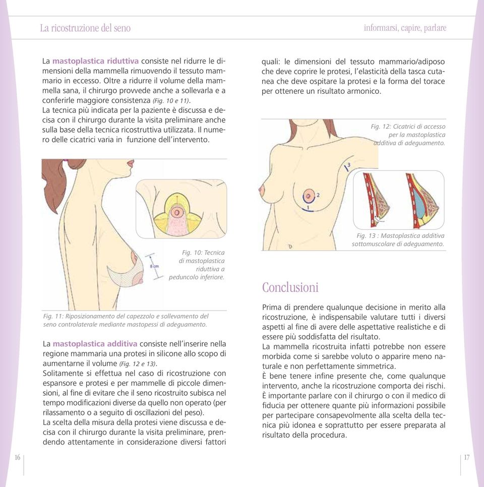 La tecnica più indicata per la paziente è discussa e decisa con il chirurgo durante la visita preliminare anche sulla base della tecnica ricostruttiva utilizzata.