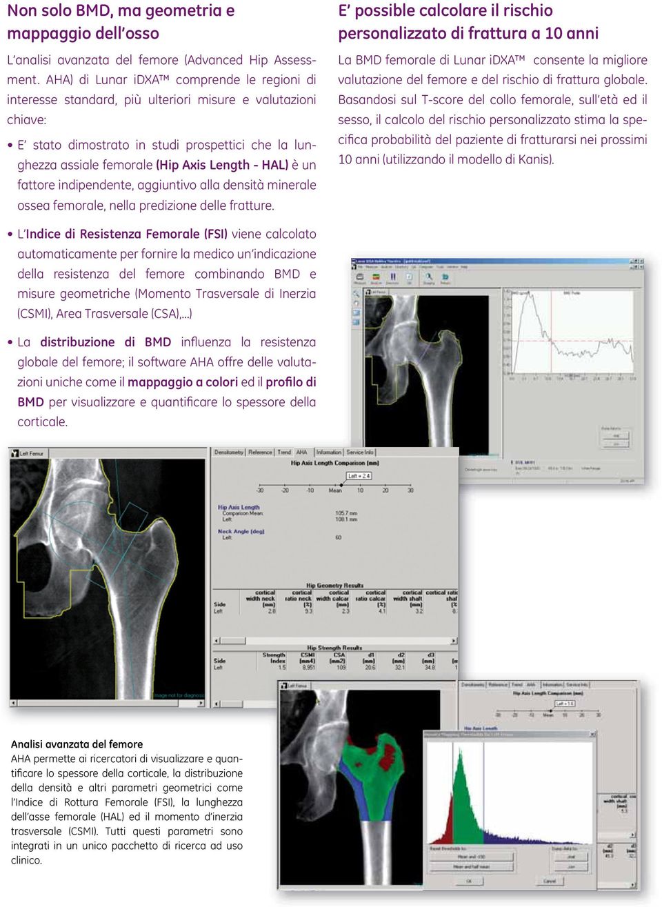 HAL) è un fattore indipendente, aggiuntivo alla densità minerale ossea femorale, nella predizione delle fratture.