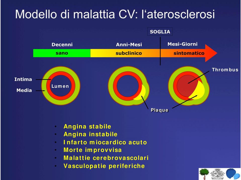 Lumen Plaque Angina stabile Angina instabile Infarto miocardico