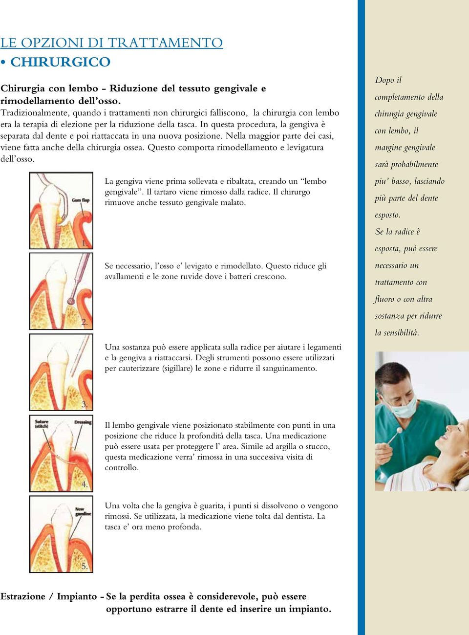 In questa procedura, la gengiva è separata dal dente e poi riattaccata in una nuova posizione. Nella maggior parte dei casi, viene fatta anche della chirurgia ossea.