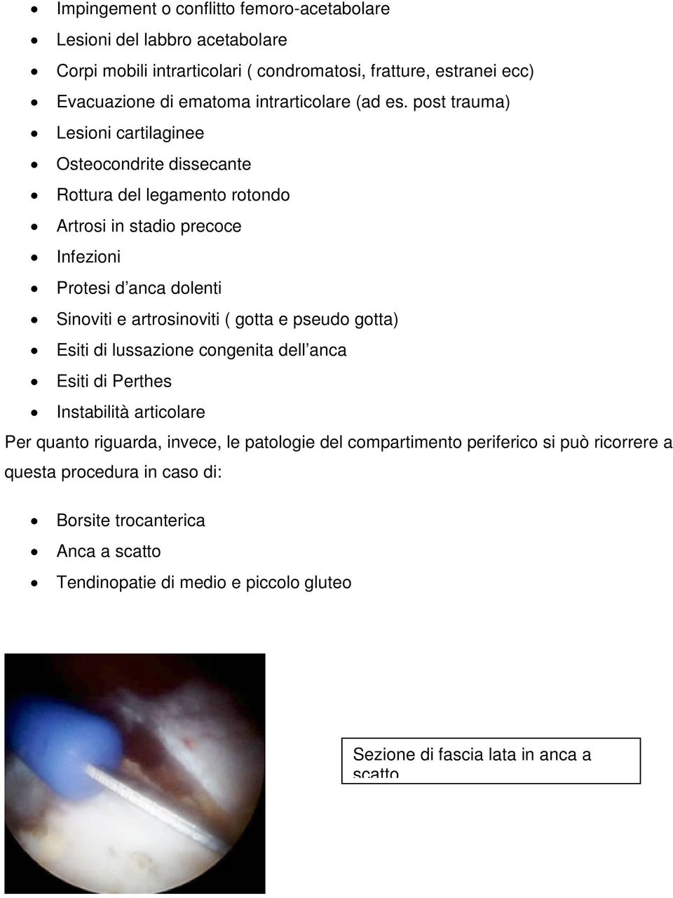 post trauma) Lesioni cartilaginee Osteocondrite dissecante Rottura del legamento rotondo Artrosi in stadio precoce Infezioni Protesi d anca dolenti Sinoviti e artrosinoviti (