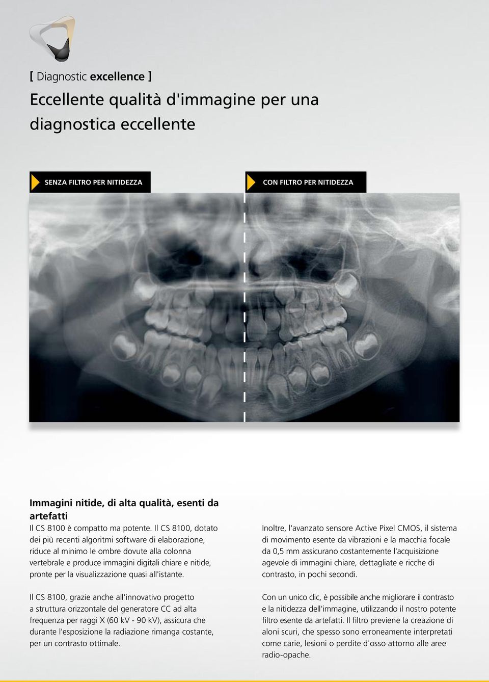 Il CS 8100, dotato dei più recenti algoritmi software di elaborazione, riduce al minimo le ombre dovute alla colonna vertebrale e produce immagini digitali chiare e nitide, pronte per la