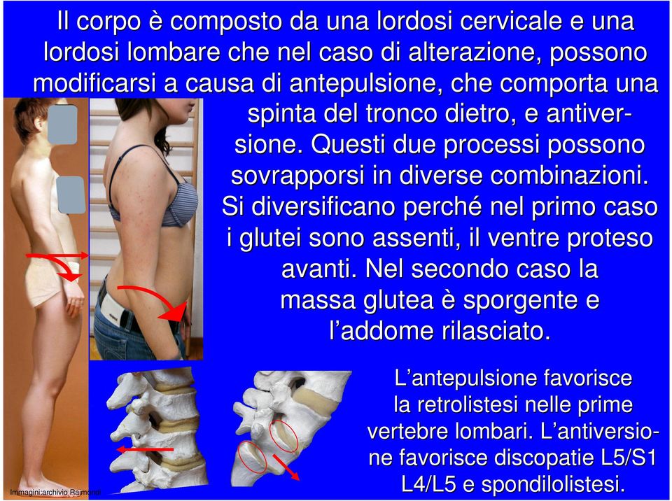 Si diversificano perché nel primo caso i glutei sono assenti, il ventre proteso avanti.