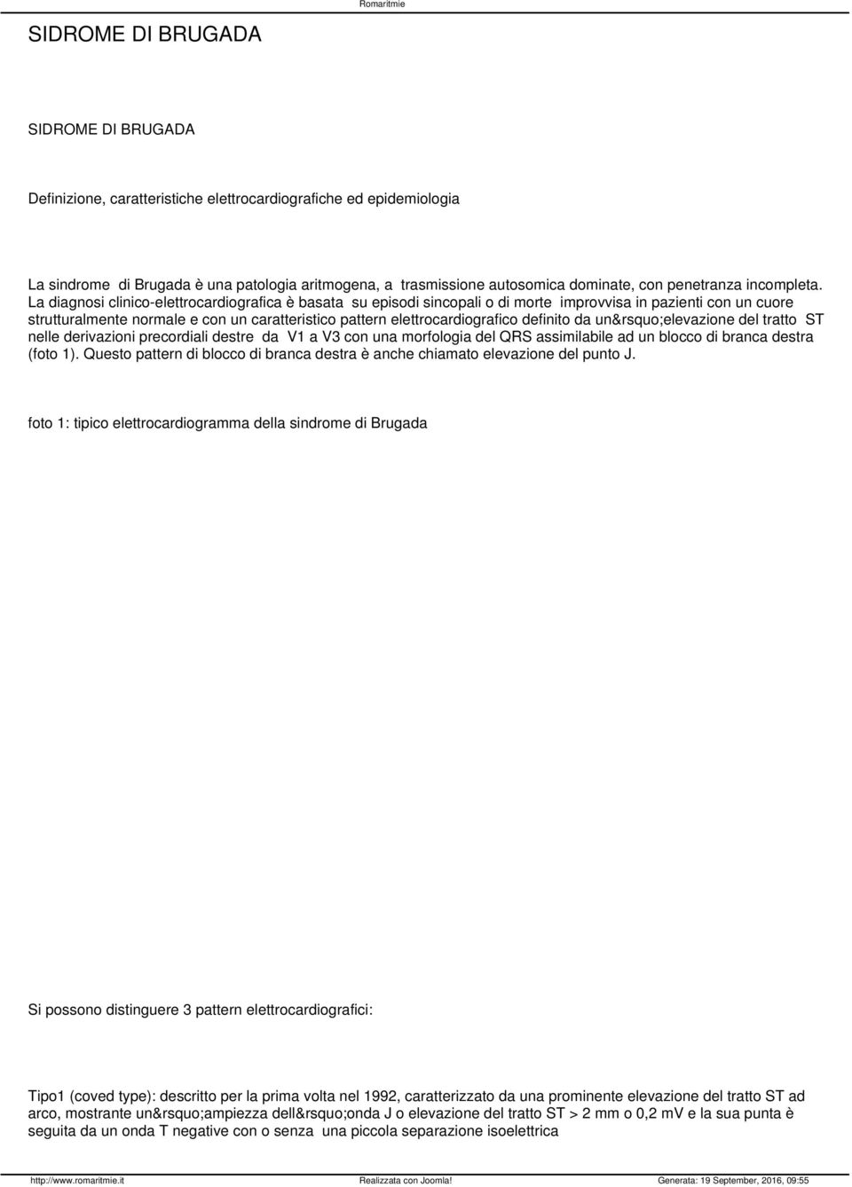 La diagnosi clinico-elettrocardiografica è basata su episodi sincopali o di morte improvvisa in pazienti con un cuore strutturalmente normale e con un caratteristico pattern elettrocardiografico